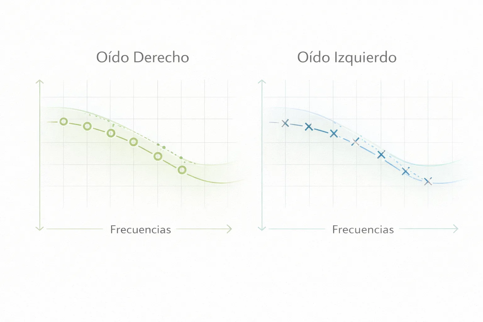 Audimetría
